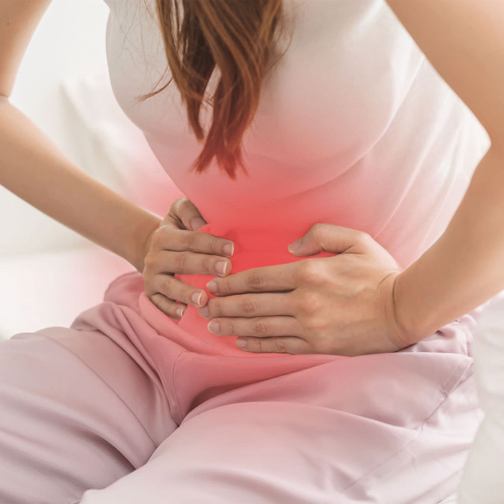 PCOS
